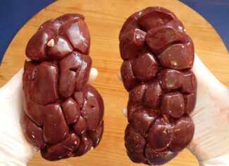 Czym się różni nerka od saszetki?